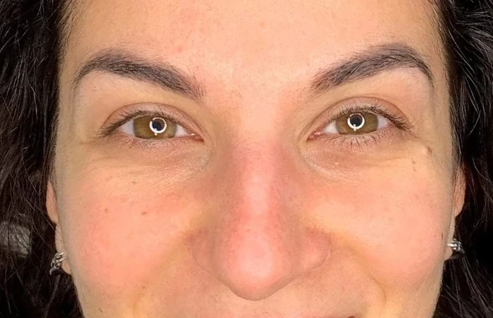 Dopo il trattamento: sopracciglia scure, piene e definite